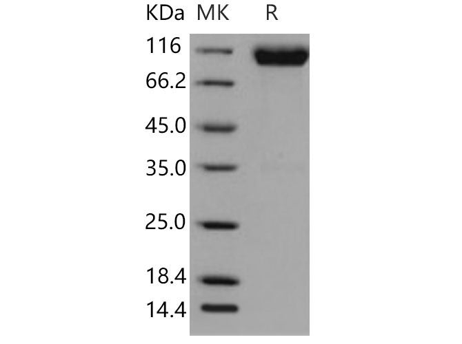 Recombinant Mouse FGFR1/CD331 Protein (Fc Tag)(Active)
