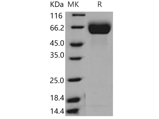 Recombinant Mouse FGFR1/CD331 Protein (His Tag)