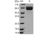 Recombinant Mouse FGFR1/CD331 Protein (His Tag)