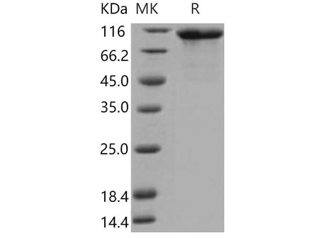 Recombinant Mouse FGFR4/CD334 Protein (His & Fc Tag)(Active)