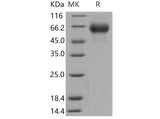 Recombinant Mouse FGFR4/CD334 Protein (His Tag)