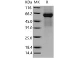 Recombinant Mouse FGFRL1/FGFR5 Protein (His Tag)(Active)