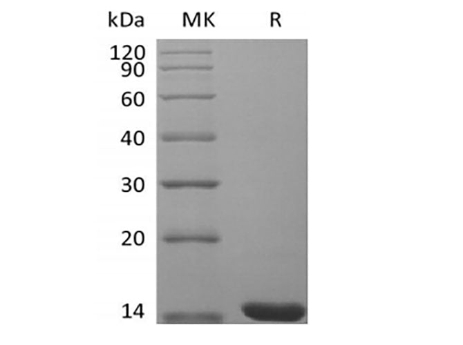 Recombinant Mouse Fibroblast Growth Factor 4/FGF-4 