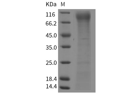 Recombinant Mouse FLT-3/FLK-2 Protein (His Tag)