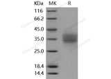 Recombinant Mouse IL7RA/CD127 Protein (His Tag)