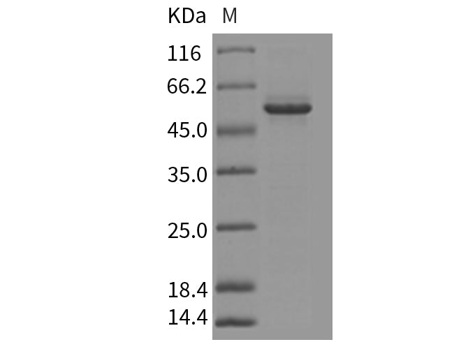 Recombinant Mouse GFOD2 Protein (His Tag)