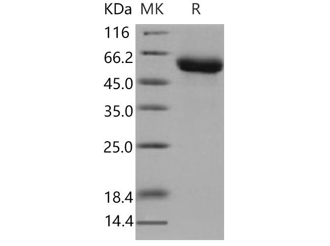 Recombinant Mouse GFRA1/GDNFRA Protein (His Tag)(Active)