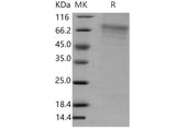 Recombinant Mouse GFRA2/GFRα2/GDNFRB Protein (His Tag)