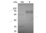 Recombinant Mouse GHR/GHBP Protein (His Tag)(Active)