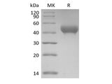 Recombinant Mouse GP6/GPVI (C-6His)