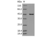 Recombinant Mouse HDAC8/HDACL1 Protein (His Tag)