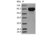 Recombinant Mouse Hemopexin/HPX Protein (His Tag)(Active)