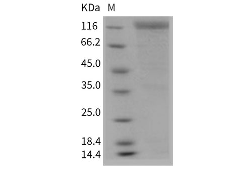 Recombinant Mouse HER2/ErbB2 Protein (Fc Tag)