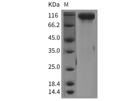 Recombinant Mouse HER4/ErbB4 Protein (His Tag)(Active)