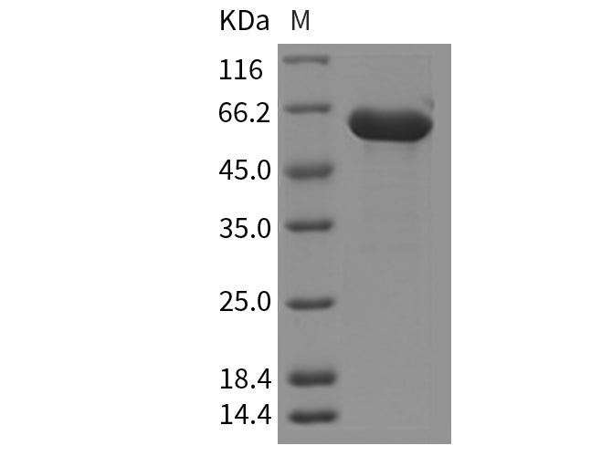 Recombinant Mouse HEXB/Hexosaminidase B Protein (His Tag)
