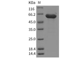 Recombinant Mouse HEXB/Hexosaminidase B Protein (His Tag)