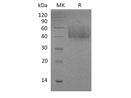 Recombinant Mouse ICOS Ligand/ICOSL Protein (His Tag)