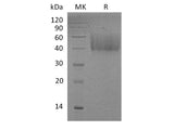 Recombinant Mouse ICOS Ligand/ICOSL Protein (His Tag)