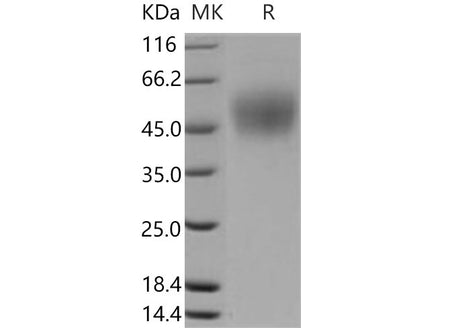 Recombinant Mouse ICOS Ligand/ICOSL Protein (His Tag)(Active)