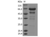 Recombinant Mouse IGFBP-2/IGFBP2 Protein (Fc Tag)