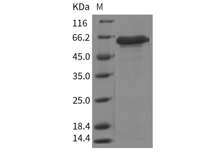 Recombinant Mouse IGFBP-7/IGFBP7 Protein (Fc Tag)