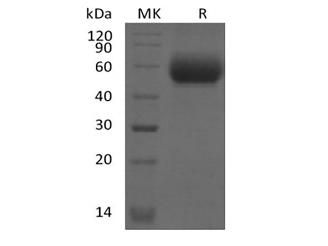 Recombinant Mouse IL-1 Receptor-Like 2/IL-1RL2/IL-1Rrp2/IL-36R (C-6His)