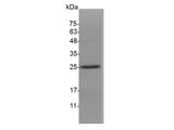 Recombinant Mouse IL-12 p35 protein(N-His)(active)