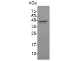 Recombinant Mouse IL-12 p40 protein(N-His)(active)