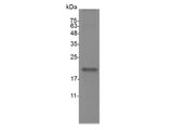 Recombinant Mouse IL-19 protein(N-His)(active)