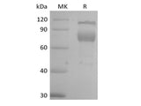 Recombinant Mouse IL-2 Receptor Subunit Beta/IL-2RB/CD122 (C-Fc)