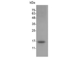 Recombinant Mouse IL-21 protein(N-His)(active)