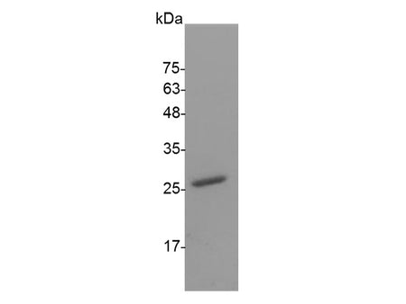 Recombinant Mouse IL-30 protein(N-His)(active)