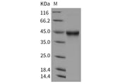 Recombinant Mouse IL-5RA/IL-5 Rα Protein (Baculovirus, His Tag) (Active)