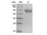 Recombinant Mouse IL-6 Receptor Subunit  alpha/IL-6RA/CD126 (C-6His)