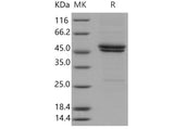 Recombinant Mouse IL11RA/IL11Rα Protein (His Tag)(Active)
