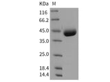 Recombinant Mouse IL17BR/IL17RB Protein (His Tag)(Active)