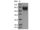 Recombinant Mouse IL17RA Protein (His Tag)(Active)