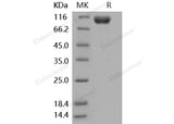Recombinant Mouse IL18R1/CD218a Protein (His & Fc Tag)(Active)