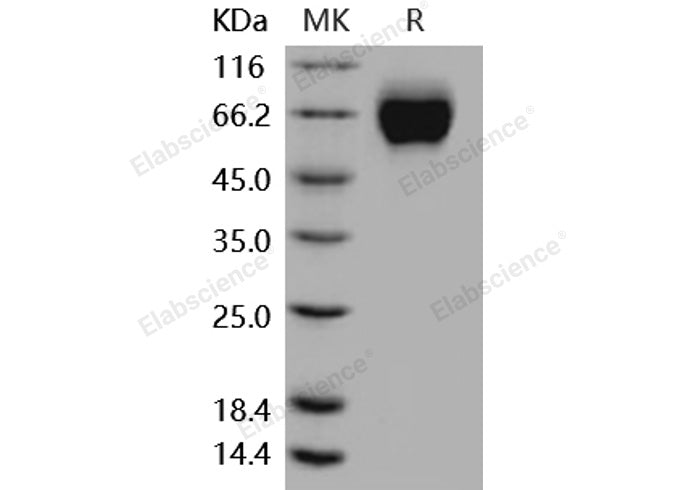 Recombinant Mouse IL18R1/CD218a Protein (His Tag)