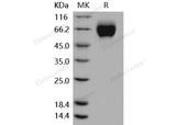 Recombinant Mouse IL18R1/CD218a Protein (His Tag)