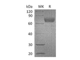 Recombinant Mouse IL4RA/CD124 Protein (Fc Tag)