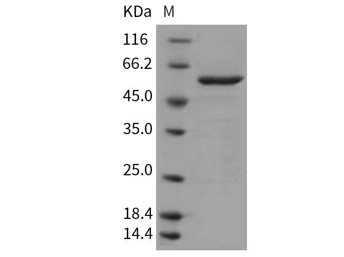 Recombinant Mouse ITK Kinase Protein (aa 351-619, His & GST Tag)