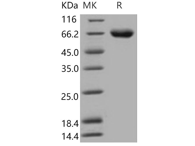 Recombinant Mouse KIRREL1/NEPH1 Protein (His Tag)(Active)