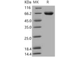 Recombinant Mouse KIRREL1/NEPH1 Protein (His Tag)(Active)
