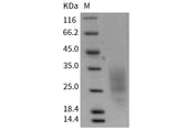 Recombinant Mouse LAIR1 Protein (aa 22-133, His Tag)