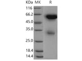 Recombinant Mouse Legumain/LGMN Protein (His Tag)(Active)
