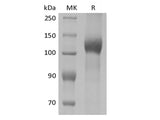 Recombinant Mouse Leptin Receptor/LEPR/CD295 (C-10His)