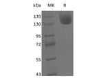 Recombinant Mouse Leptin Receptor/LEPR/CD295 (C-Fc)