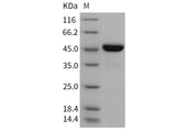 Recombinant Mouse LRPAP1/A2MRAP Protein (His Tag)(Active)