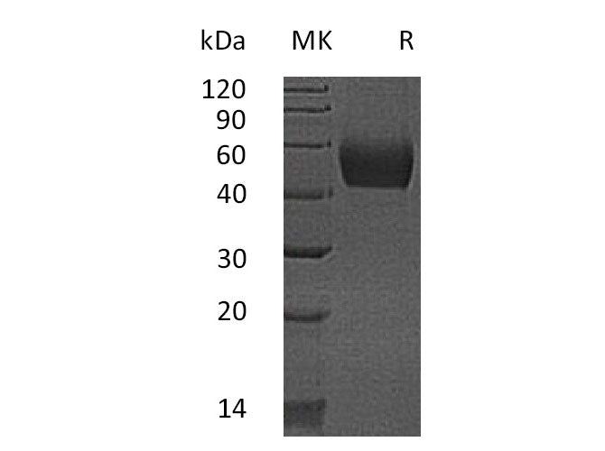 Recombinant Mouse Lumican/LUM Protein (His Tag)